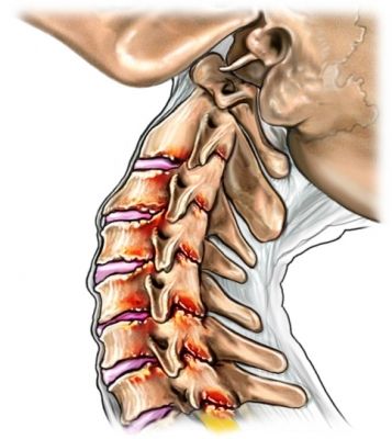 best mattress for neck pain